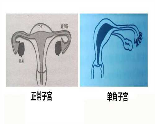 北京代孕微信群，在北京怀孕选择北京协和医院还是北医三院？